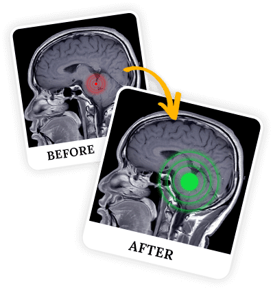 billionaire brain wave results